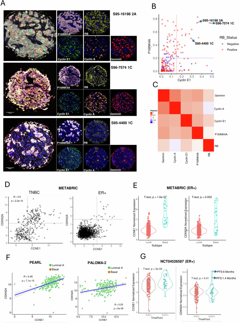 La vulnerabilidad discreta a la inhibición farmacológica de CDK2 está determinada por la heterogeneidad del ciclo celular del cáncer