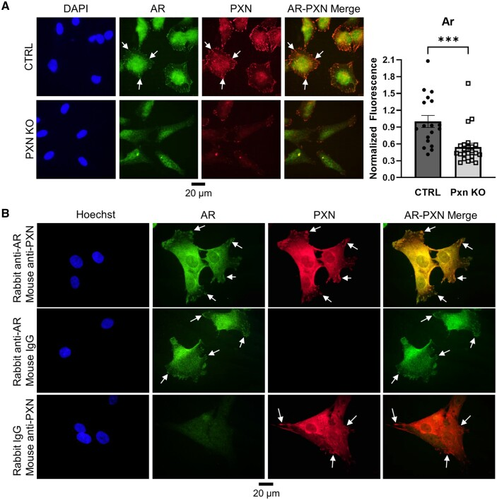 La paxilina regula la expresión del receptor de andrógenos asociado con las adherencias focales de las células de la granulosa